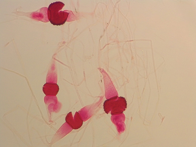 Rhizopus Slides - Rhizopus 01 100X
